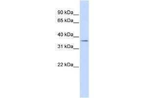 WB Suggested Anti-TRIM69 Antibody Titration:  0. (TRIM69 抗体  (N-Term))