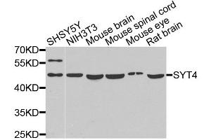 Western blot analysis of extracts of various cell lines, using SYT4 antibody (ABIN5975174) at 1/1000 dilution. (SYT4 抗体)