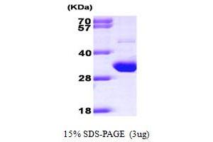 SDS-PAGE (SDS) image for TP53 induced glycolysis regulatory phosphatase (TIGAR) (AA 1-270) protein (His tag) (ABIN7279263) (TIGAR Protein (AA 1-270) (His tag))