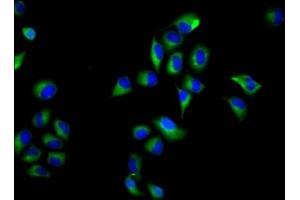 Immunofluorescence staining of Hela cells with ABIN7161019 at 1:66, counter-stained with DAPI. (NOXO1 抗体  (AA 304-376))