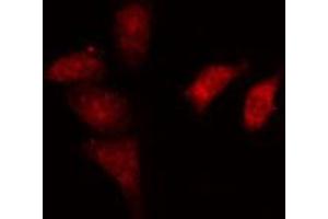 ABIN6274164 staining HeLa cells by IF/ICC. (NR2F6 抗体  (N-Term))