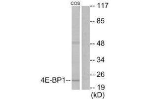 Western blot analysis of extracts from COS7 cells, treated with EGF (200 ng/mL, 30 mins), using 4E-BP1 (Ab-69) antibody.