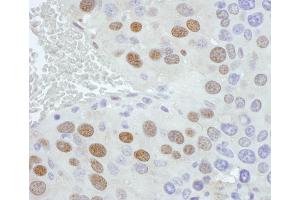 Immunohistochemistry (IHC) image for anti-Phosphate Cytidylyltransferase 1, Choline, alpha (PCYT1A) (AA 1-50) antibody (ABIN7454584)