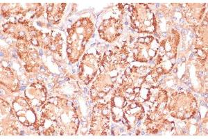 Immunohistochemistry of paraffin-embedded Mouse kidney using MAP2K3 Polyclonal Antibody at dilution of 1:100 (40x lens). (MAP2K3 抗体)