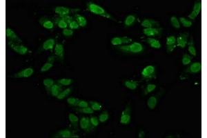 Immunofluorescence staining of Hela cells with ABIN7171577 at 1:100, counter-stained with DAPI. (TAF15 抗体  (AA 93-206))