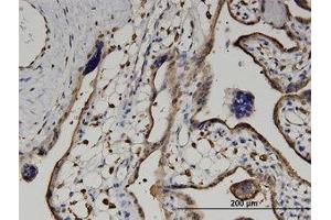 Image no. 4 for anti-Ureidopropionase, beta (UPB1) (AA 285-385) antibody (ABIN599563) (UPB1 抗体  (AA 285-385))