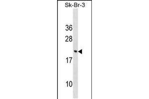 Western blot analysis in SK-BR-3 cell line lysates (35ug/lane). (CNIH3 抗体  (N-Term))