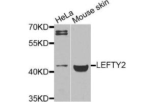 Western blot analysis of extracts of various cell lines, using LEFTY2 antibody (ABIN6003578) at 1/1000 dilution. (LEFTY2 抗体)