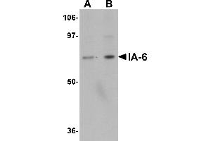 Western blot analysis of IA-6 in rat thymus tissue lysate with IA-6 antibody at (A) 1 and (B) 2 µg/mL. (INSM2 抗体  (C-Term))