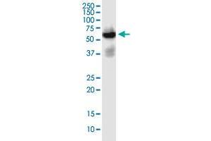 SLC22A2 monoclonal antibody (M02), clone 1E3. (SLC22A2 抗体  (AA 261-370))