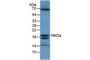 Detection of ECO in Ecoli Cells using Polyclonal Antibody to Ecotin (ECO) (Ecotin (AA 21-162) 抗体)