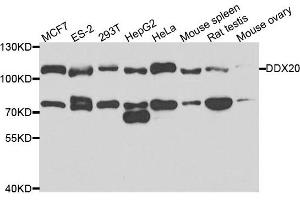 Western blot analysis of extracts of various cell lines, using DDX20 antibody. (DDX20 抗体)