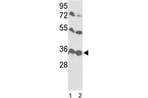Western blot analysis of VDAC1 antibody and 1) HL-60 and 2) Y79 lysate. (VDAC1 抗体  (AA 95-124))