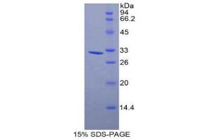 SDS-PAGE (SDS) image for Myosin Light Chain Kinase 3 (MYLK3) (AA 488-750) protein (His tag) (ABIN2121718) (MYLK3 Protein (AA 488-750) (His tag))