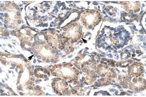 Human kidney; RGS20 antibody - middle region in Human kidney cells using Immunohistochemistry (RGS20 抗体  (all Isoforms, Middle Region))