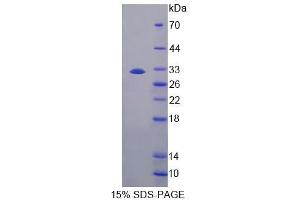 SDS-PAGE analysis of Mouse CES1 Protein. (CES1 蛋白)