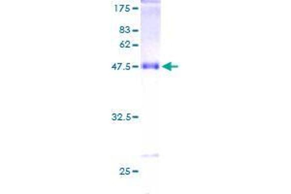 Stathmin 3 Protein (STMN3) (AA 1-180) (GST tag)