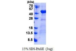 Figure annotation denotes ug of protein loaded and % gel used. (DNAJB4 蛋白)