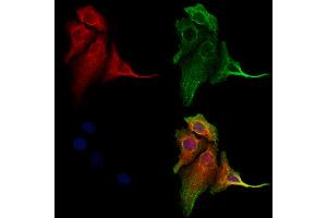 ABIN6260408 and ABIN6273204 staining Hela cells by IF/ICC. (CALCOCO2 抗体  (Internal Region))