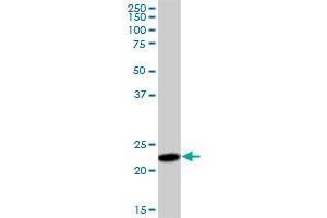 Western Blotting (WB) image for anti-Signal Sequence Receptor, beta (Translocon-Associated Protein Beta) (SSR2) (AA 1-186) antibody (ABIN520505)