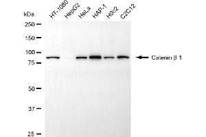 Western blotting analysis using catenin beta 1 antibody (ABIN7797932).