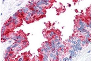 Human Prostate: Formalin-Fixed, Paraffin-Embedded (FFPE) (ADAM20 抗体  (Internal Region))