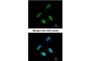 ICC/IF Image Immunofluorescence analysis of paraformaldehyde-fixed HeLa, using TAP, antibody at 1:200 dilution. (NXF1 抗体  (C-Term))