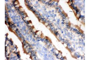 Immunohistochemistry (IHC) image for anti-Isocitrate Dehydrogenase 1 (NADP+), Soluble (IDH1) (AA 381-413), (C-Term) antibody (ABIN3043855)