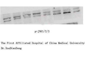 Western Blot (WB) analysis: Please contact us for more details. (JNK 抗体  (pThr183, pTyr185))