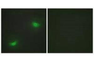 Immunofluorescence analysis of HepG2 cells, using DUSP16 antibody. (DUSP16 抗体)