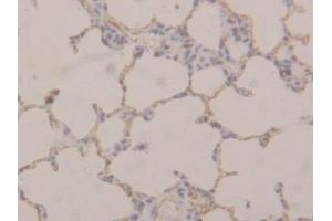 Detection of TM in Rat Lung Tissue using Polyclonal Antibody to Thrombomodulin (TM) (Thrombomodulin 抗体  (AA 324-480))
