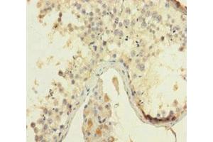 Immunohistochemistry of paraffin-embedded human testis tissue using ABIN7155217 at dilution of 1:100 (HMGB4 抗体  (AA 1-186))