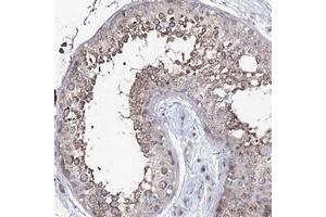 Immunohistochemical staining of human testis with PUS3 polyclonal antibody  shows moderate cytoplasmic positivity in cells in seminiferus ducts at 1:50-1:200 dilution. (PUS3 抗体)