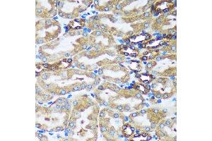Immunohistochemistry of paraffin-embedded Mouse kidney using FBXO21 Rabbit pAb (ABIN7267085) at dilution of 1:100 (40x lens). (FBXO21 抗体  (AA 440-621))