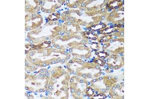 Immunohistochemistry of paraffin-embedded Mouse kidney using FBXO21 Rabbit pAb (ABIN7267085) at dilution of 1:100 (40x lens).
