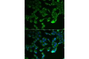Immunofluorescence analysis of HeLa cells using C1R antibody (ABIN5973769). (C1R 抗体)