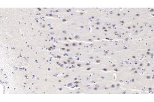 Immunohistochemistry (IHC) image for anti-PSME3 (PSME3) (AA 7-254) antibody (ABIN7441328)