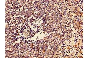 Immunohistochemistry of paraffin-embedded human spleen tissue using ABIN7147027 at dilution of 1:100 (Cathepsin Z 抗体  (AA 127-287))