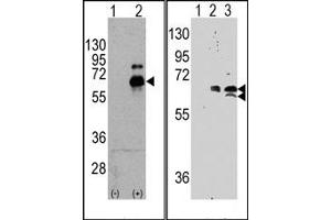 Image no. 2 for anti-Ribosomal Protein S6 Kinase, 70kDa, Polypeptide 1 (RPS6KB1) (Ser424) antibody (ABIN358260) (RPS6KB1 抗体  (Ser424))