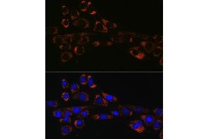 Immunofluorescence analysis of NIH-3T3 cells using HSP47/SERPINH1 Rabbit mAb (ABIN7270238) at dilution of 1:100 (40x lens). (SERPINH1 抗体)