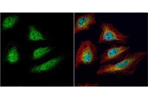 ICC/IF Image CDC34 antibody [N1C3] detects CDC34 protein at cytoplasm and nucleus by immunofluorescent analysis.