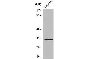 Western Blot analysis of COLO205 cells using UBCE7IP4 Polyclonal Antibody (RNF144A 抗体  (Internal Region))