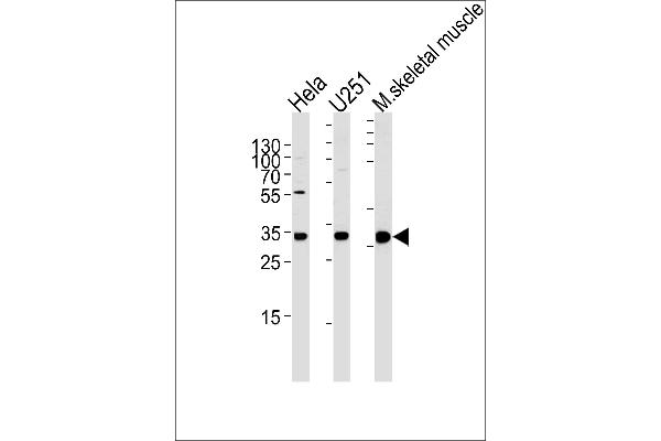 POLR2C 抗体  (C-Term)