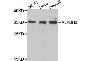 Western blot analysis of extracts of various cell lines, using ALKBH2 antibody (ABIN5974451) at 1/1000 dilution. (ALKBH2 抗体)