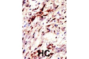 Immunohistochemistry (IHC) image for anti-SUMO (pan) antibody (ABIN2997018) (SUMO 抗体  (pan))