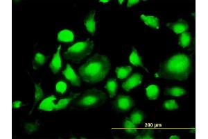 Immunofluorescence of monoclonal antibody to MAPK1 on HeLa cell. (ERK2 抗体  (AA 261-360))