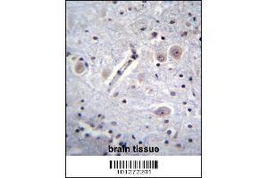 MARK Antibody immunohistochemistry analysis in formalin fixed and paraffin embedded human brain tissue followed by peroxidase conjugation of the secondary antibody and DAB staining. (MARK1 抗体  (C-Term))