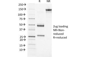 SDS-PAGE Analysis Purified BRCA1 Mouse Monoclonal Antibody (BRCA1/1472). (BRCA1 抗体  (AA 445-620))