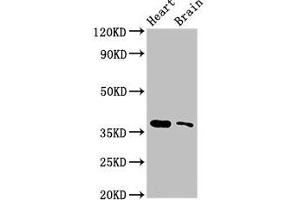 Western Blot Positive WB detected in: Mouse heart tissue, Mouse brain tissue All lanes: SRR antibody at 3 μg/mL Secondary Goat polyclonal to rabbit IgG at 1/50000 dilution Predicted band size: 37 kDa Observed band size: 37 kDa (SRR 抗体  (AA 1-340))