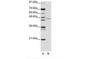Image no. 1 for anti-Tripartite Motif Containing 14 (TRIM14) (AA 116-165) antibody (ABIN203143) (TRIM14 抗体  (AA 116-165))